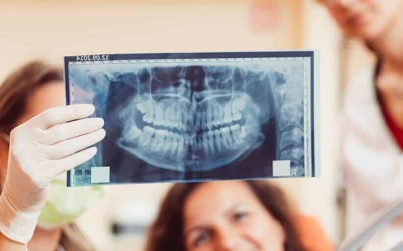 Radiografía Panoramica Dental: Costos y Beneficios